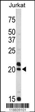 VIP Antibody