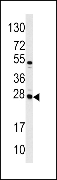CASA Antibody