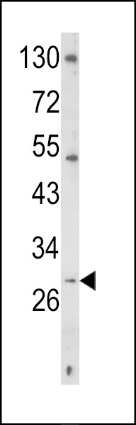 CD40LG Antibody
