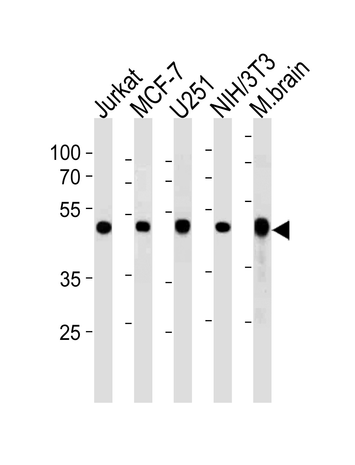 ENO1 Antibody