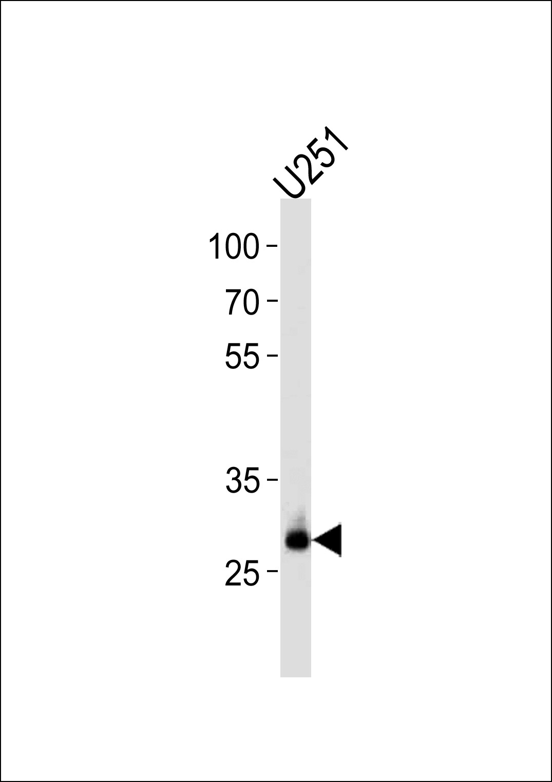 CNOT8 Antibody