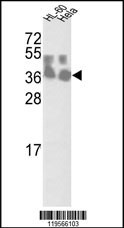 CLNS1A Antibody