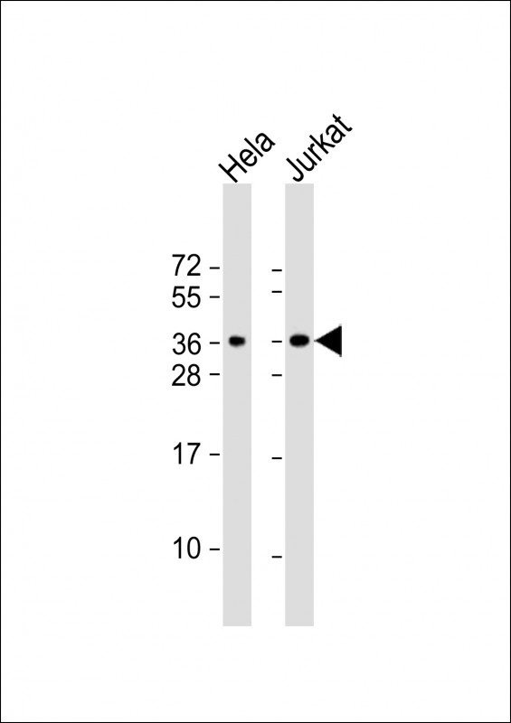 CLNS1A Antibody