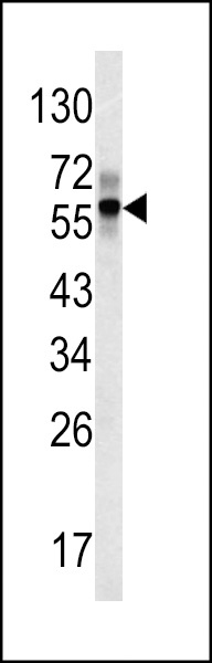 FIBB Antibody