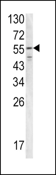FIBB Antibody