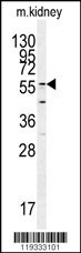 GADL1 Antibody