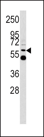 UDB17 Antibody