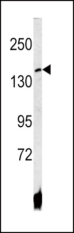 ATP7B Antibody