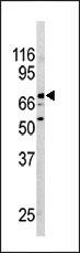 NR4A2 Antibody