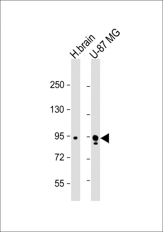 SNCAIP Antibody