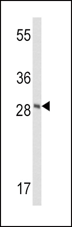 FXN Antibody