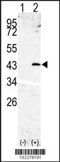 SPPL3 Antibody