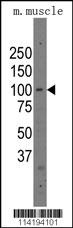 Parp12 Antibody