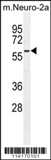 PARP6 Antibody