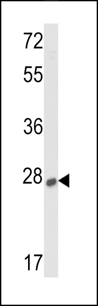 SOST Antibody