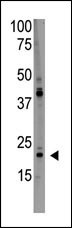 PDAP1 Antibody