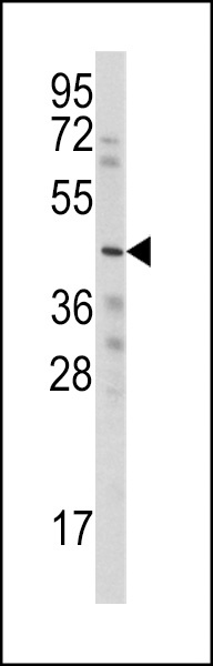WISP3 Antibody