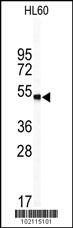 WISP1 Antibody