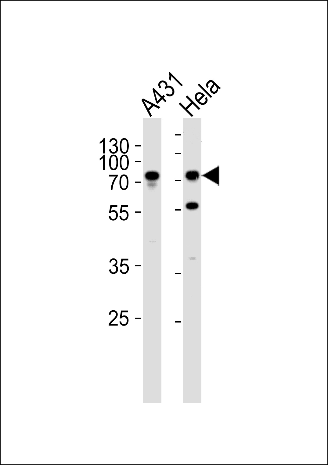 SEPT9 Antibody