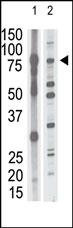 MMP15 Antibody