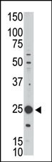 MAGEH1 Antibody