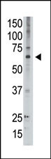 MAGED2 Antibody