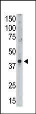 MAGEA9 Antibody