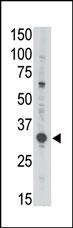 MAGEA3 Antibody