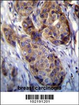 MAGEA12 Antibody