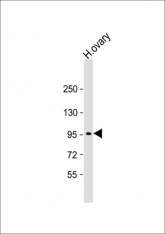 LRP3 Antibody