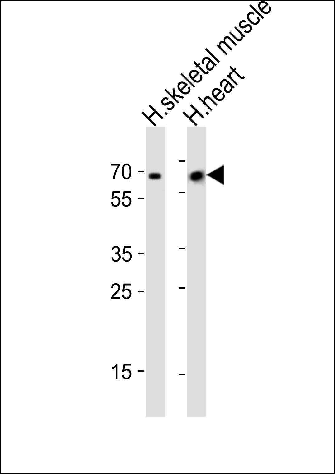 CRY2 Antibody