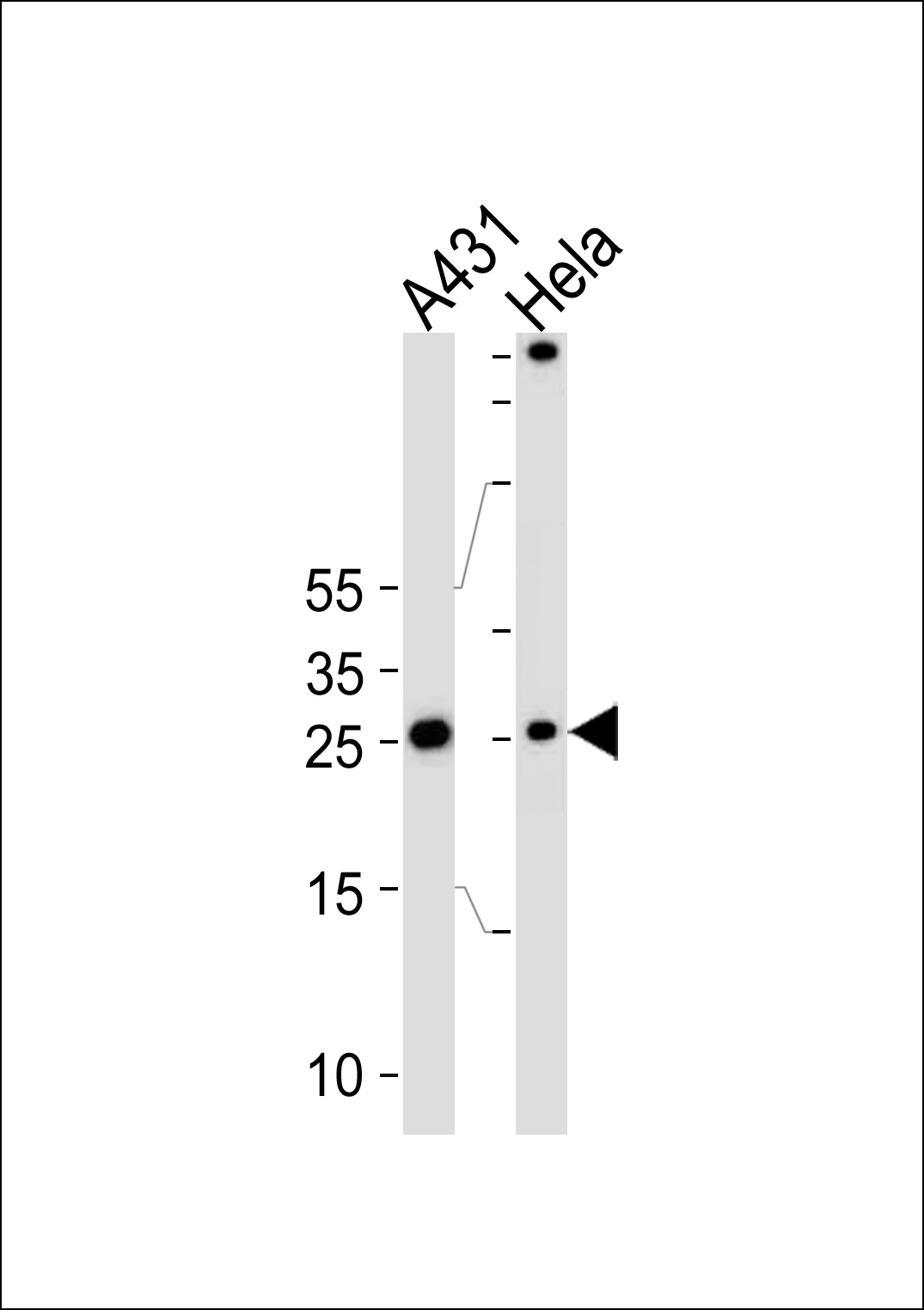 SFN Antibody