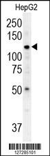 ATP13A3 Antibody