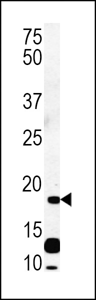 DNPH1 Antibody