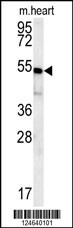 HEY2 Antibody