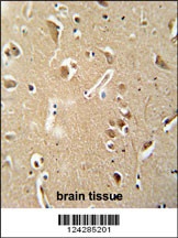 CILP2 Antibody