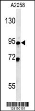 SMPD4 Antibody