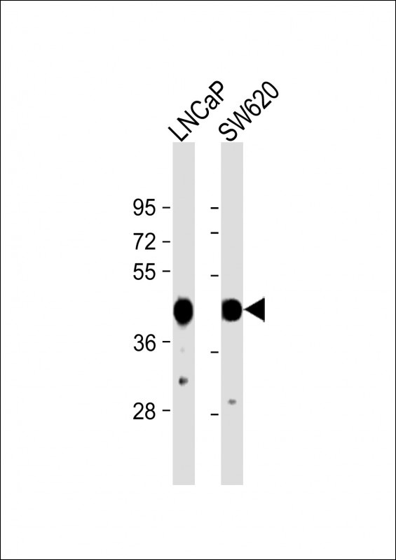 CS Antibody