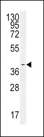 SMS Antibody