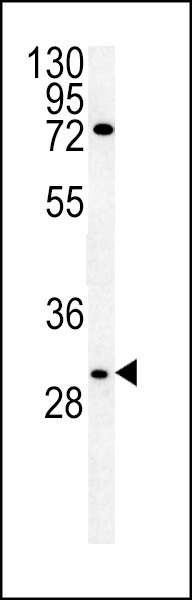 CLDN12 Antibody