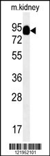 MEP1A Antibody