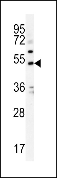 KCNJ6 Antibody