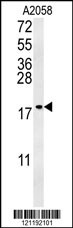 GM2A Antibody