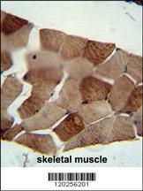 ST3GAL5 Antibody