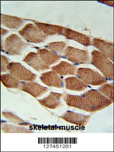 ARHGEF3 Antibody