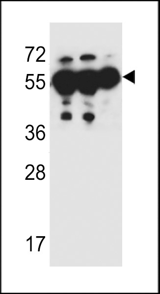 ANKRD57 Antibody