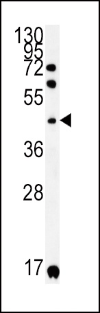 KIR2DS2 Antibody