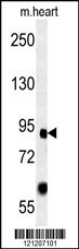 FOXP2 Antibody