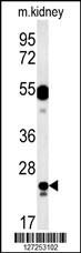 LYSMD1 Antibody
