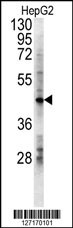 LDHD Antibody